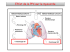 Problématique de la PPC autopilotée chez l`insuffisant cardiaque