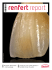 Nouveaut&eacute; ! Renfert Polish &ndash; L`art du polissage &laquo; Forage pour pins
