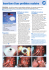 Insertion d`une proth&egrave;se oculaire 19