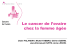 Le cancer de l`ovaire chez la femme âgée