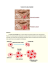 Cancer de la prostate
