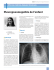 Pleuropneumopathie de l`enfant