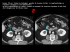 pecysts(FILEminimizer) - Les cliniques radiologiques de l`Oncle