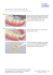 Flowchart Variolink Esthetic - Cementation Navigation System