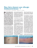 Que faire devant une allergie medicamenteuse