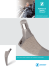 Prothese de hanche Fitmore Informations