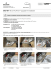 EKG-401 Upgrade Kit Install